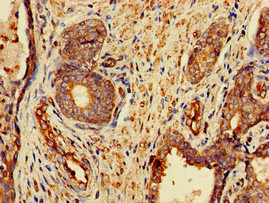 CSB-PA891570LA01HU