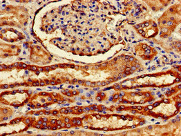 CSB-PA891570LA01HU