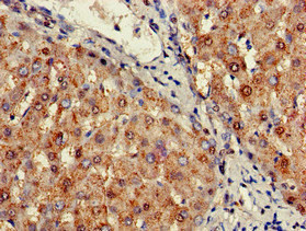 CSB-PA896485LA01HU