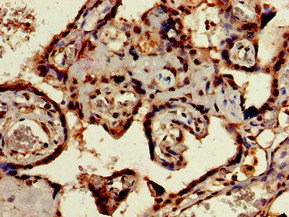 CSB-PA896485LA01HU