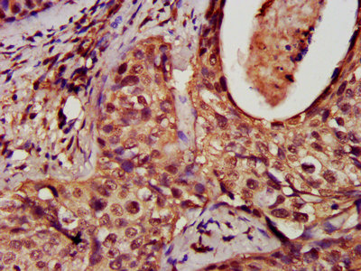 CSB-PA007078EA01HU