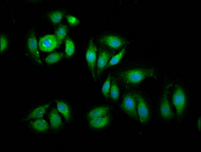 CSB-PA007503LA01HU