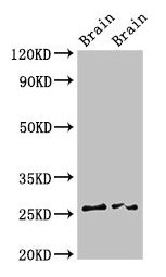 CSB-PA008227LA01HU