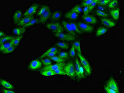 CSB-PA009792LA01HU