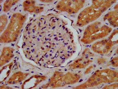 CSB-PA012903LA01HU
