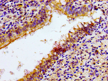CSB-PA015551LA01HU