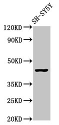 CSB-PA016361LA01HU