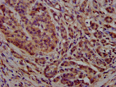CSB-PA017523LA01HU