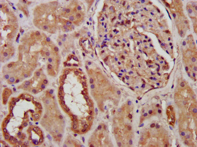CSB-PA017523LA01HU