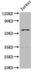 CSB-PA017523LA01HU