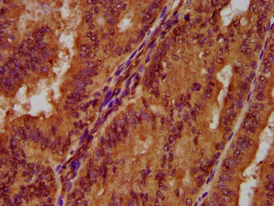 CSB-PA017862LA01HU
