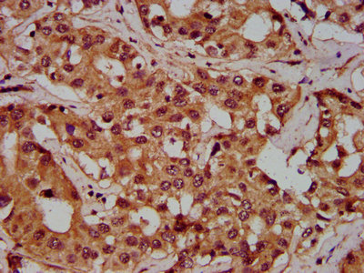 CSB-PA017862LA01HU
