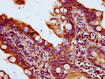 CSB-PA019144LA01HU