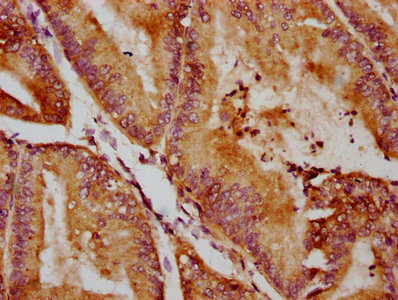 CSB-PA019144LA01HU