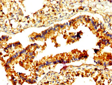 CSB-PA019305LA01HU