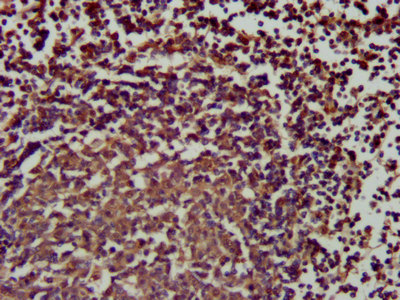 CSB-PA021368LA01HU