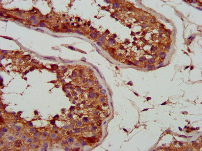 CSB-PA021518LA01HU