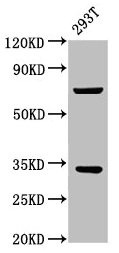 CSB-PA021518LA01HU