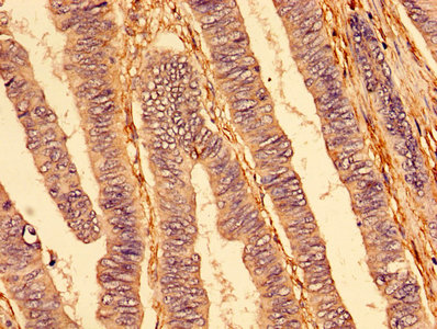 CSB-PA023964LA01HU