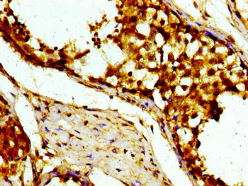 CSB-PA613516LA01HU