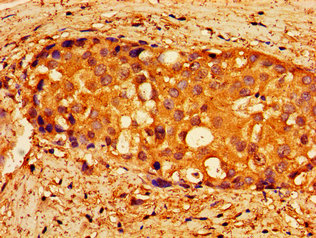 CSB-PA614901LA01HU