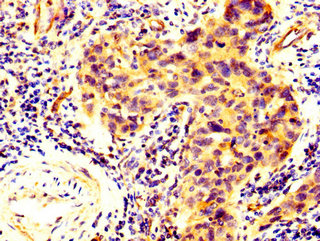 CSB-PA819471LA01HU