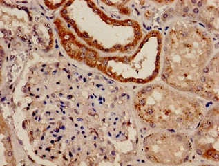 CSB-PA822163LA01HU
