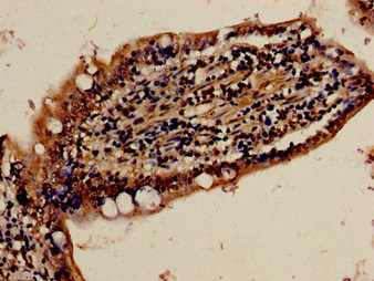 CSB-PA822163LA01HU