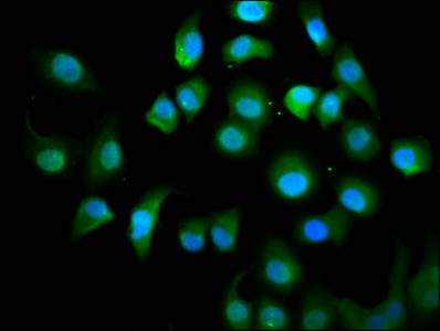CSB-PA847753LA01HU