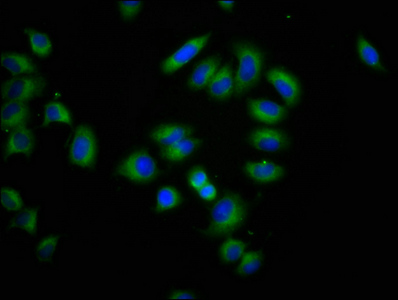 CSB-PA850323LA01HU