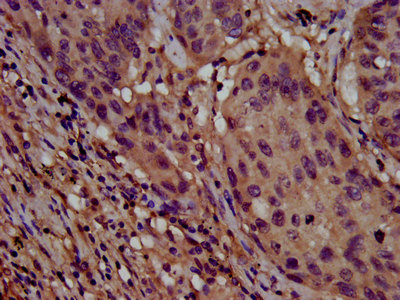 CSB-PA850323LA01HU
