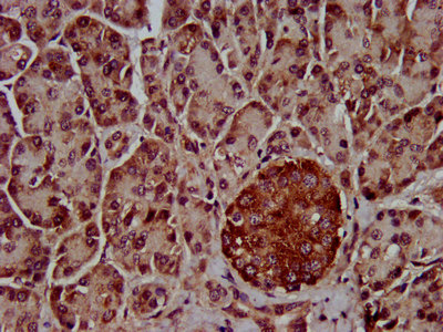 CSB-PA850323LA01HU