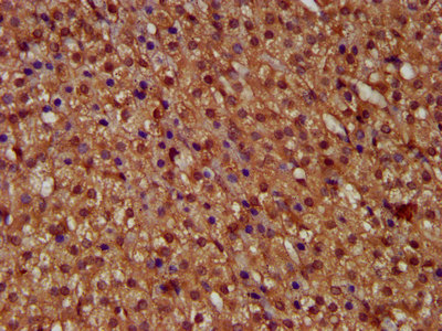 CSB-PA860652LA01HU