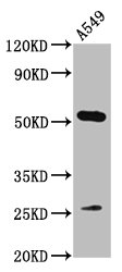 CSB-PA860652LA01HU