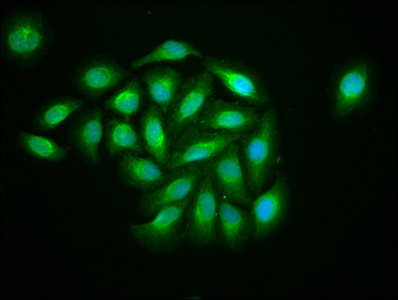 CSB-PA873625LA01HU