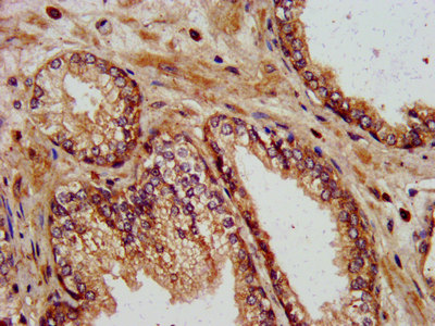 CSB-PA873625LA01HU