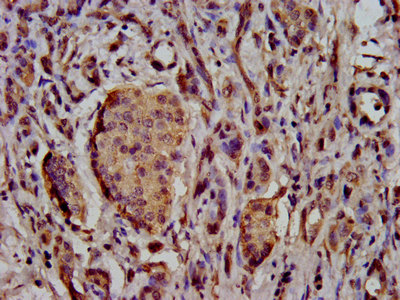 CSB-PA883417LA01HU