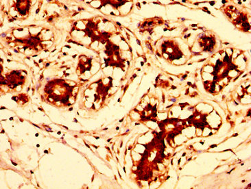 CSB-PA887159LA01HU