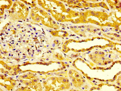CSB-PA007825LA01HU