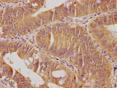 CSB-PA009018PA01HU