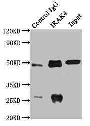 CSB-PA011812ESR1HU
