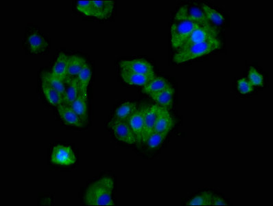 CSB-PA016361LA01HU