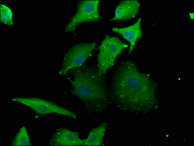 CSB-PA019235HA01HU