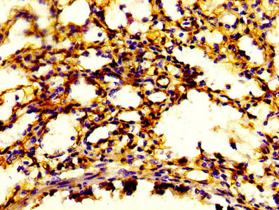 CSB-PA020632HA01HU