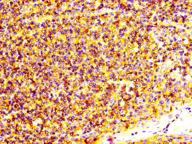 CSB-PA020632HA01HU