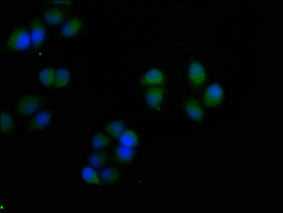 CSB-PA020635HA01HU
