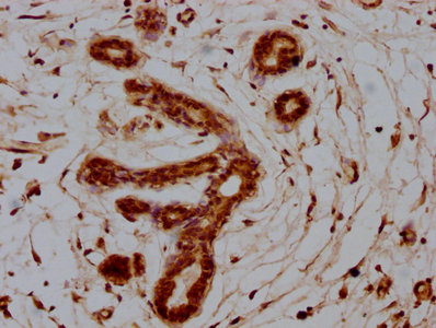 CSB-PA020635HA01HU