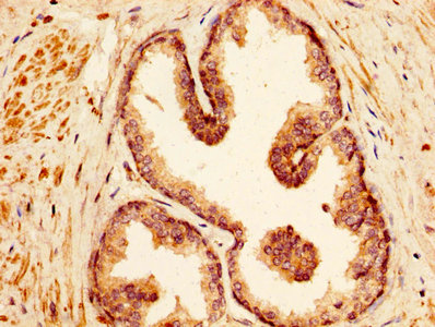 CSB-PA745337HA01HU