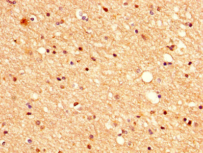 CSB-PA745337HA01HU