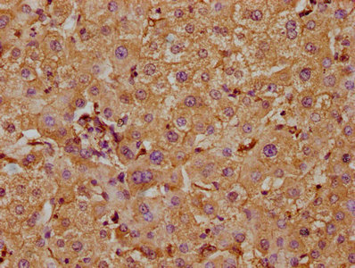 CSB-PA752101LA01HU